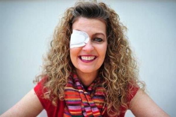 بالصور.. شاهد ماذا حدث لعين امرأة بسبب نظارات الشمس الرخيصة