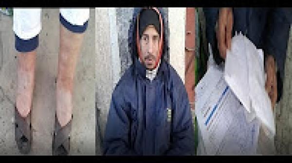 معاناة متشرد مع المرض بالحي المحمدي بالبيضاء.