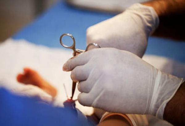 دراسة أمريكية: فوائد ختان الذكور أكثر من مخاطره