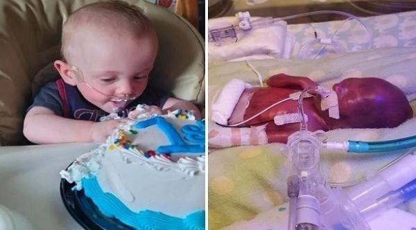 أصغر طفل في العالم ولد قبل الأوان يتحدى توقعات الأطباء ويحتفل بعيد ميلاده الأول