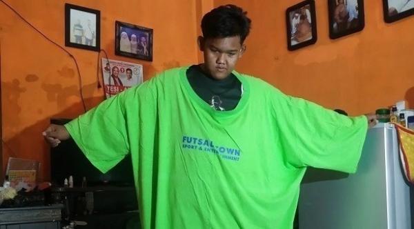 أضخم طفل في العالم يتمكن من خسارة 120 كيلوغراماً من وزنه