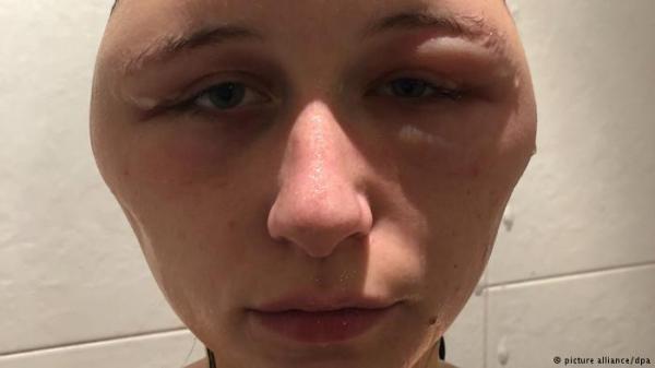 أرادت فقط تغيير لون شعرها...فصار شكلها هكذا