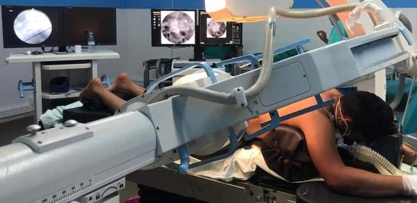 طبيب متخصص في جراحة الدماغ والعمود الفقري يُجري عمليتين جراحيتين ناجحتين بتقنيات حديثة