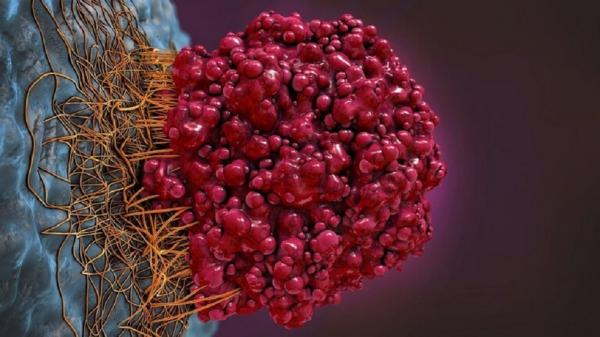 دراسة حديثة: هذه 7 عوامل مسببة للسرطان