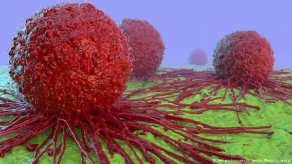 خبراء يتوقعون أن يؤثر كوفيد 19 سلبا على رعاية مرضى السرطان