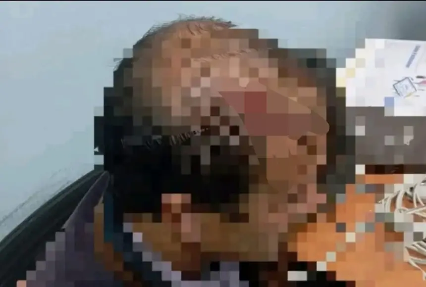 ضربة حجر من تلميذ تنقل مدير مؤسسة تعليمية إلى المستشفى والمديرية الإقليمية تدخل على الخط