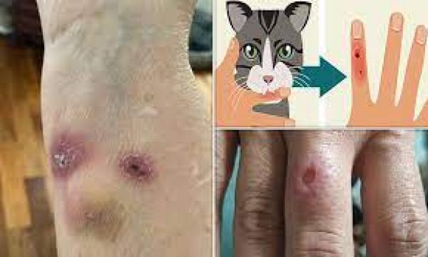 بريطانيا: اكتشاف حالات إصابة بمرض جلدي نادر ينتقل عبر القطط