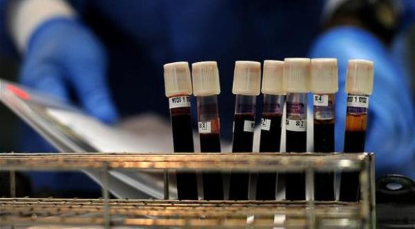 6 أمراض يمكن التنبؤ بها من خلال فئة الدم