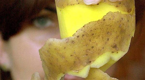 قشرة البطاطس قد تصيبك بالتسمم