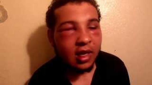 مواطن يتهم القوات المساعدة بالاعتداء عليه لامتناعه عن تقديم رشوة لهم