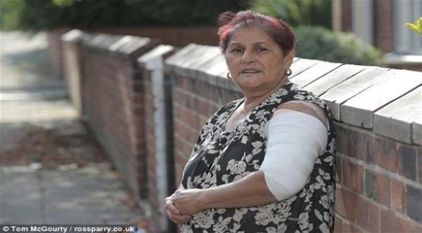 أنظر ماذا فعل كلب لذراع هذه المرأة