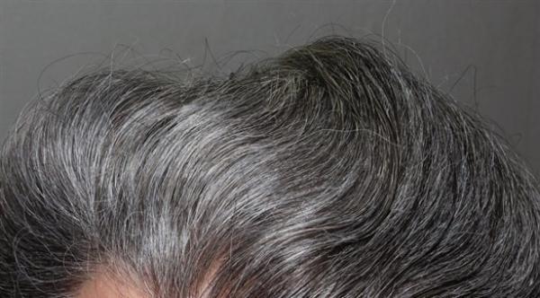 8 حقائق عن الشعر الفضي