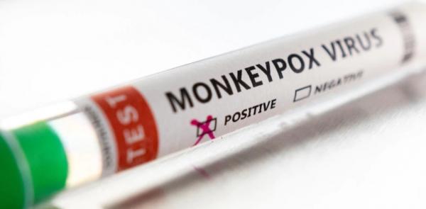 جدري القردة .. تطوير نظام اختبار PCR للكشف عن الإصابة بالفيروس