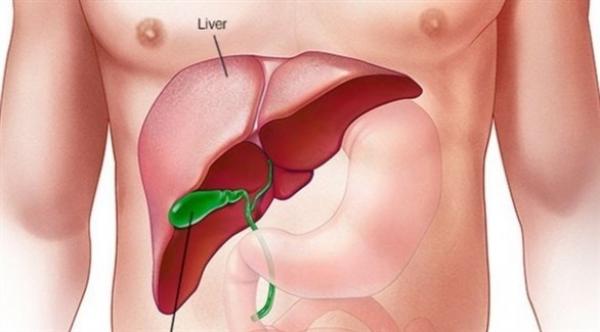 دراسة تكشف الرابط بين مرض السكري ودهون الكبد