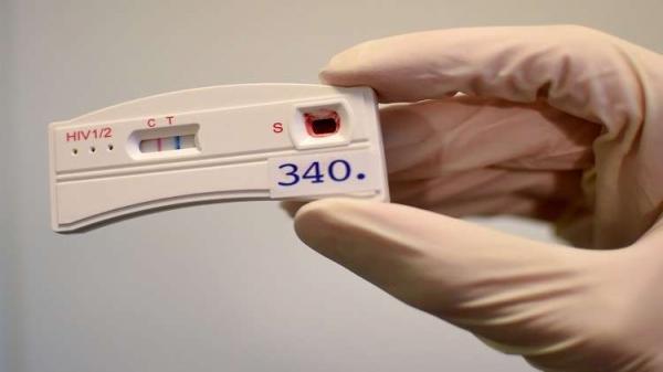 ثاني شخص في التاريخ يشفى من داء "السيدا"!