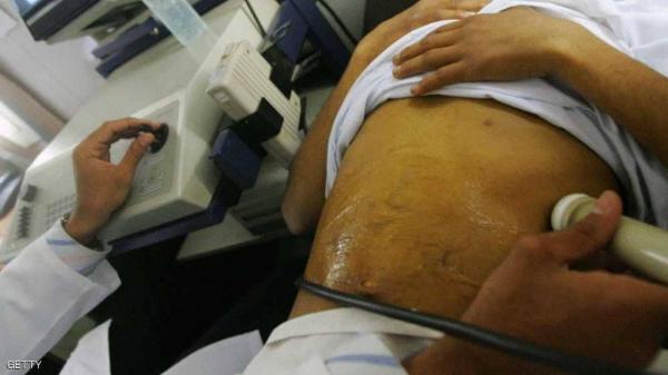 أمل جديد لمرضى تليف الكبد.. كشف قد يغني عن الزراعة