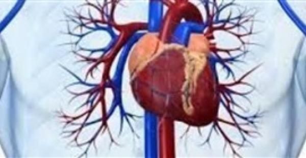 استشاري قلب: تسوس الأسنان يعرض مرضى القلب للخطر