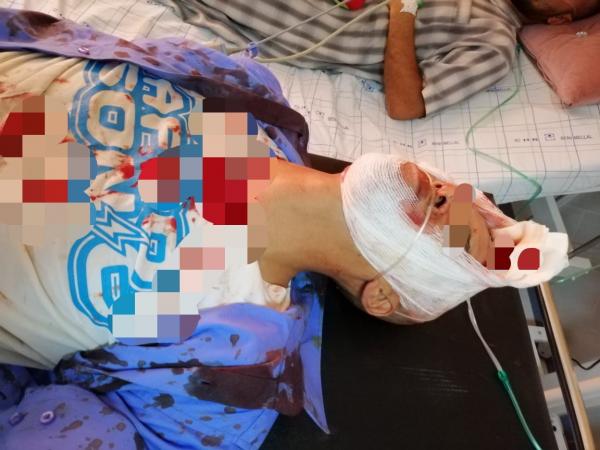 نايضة..توقيف أستاذ بتهمة الاعتداء على سكيريتي ونقل الأخير للإنعاش