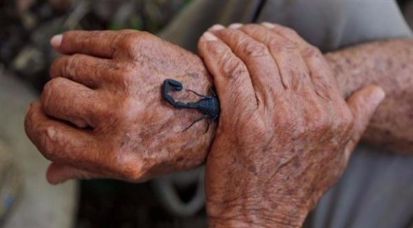 كوبي سبعيني يلدغ نفسه بعقرب شهرياً لهذا السبب