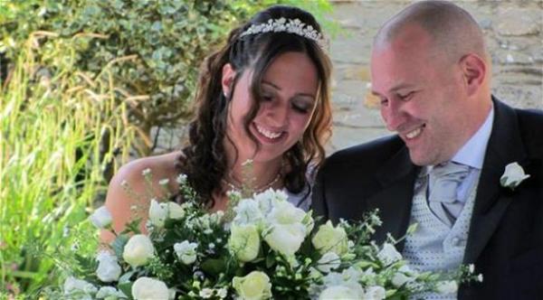 عروس بريطانية تصاب بالصلع قبل موعد زفافها
