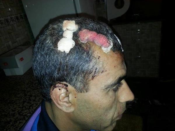 63 يوما مدة العجز لسعيد وشقيقه وأفراد العصابة لازالوا طلقاء أحرارا بخريبكة (صور)