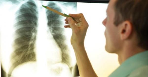 العالم يحبس أنفاسه بعد  التهاب رئوي "غامض'' قتل 6 أشخاص في الأرجنتين!