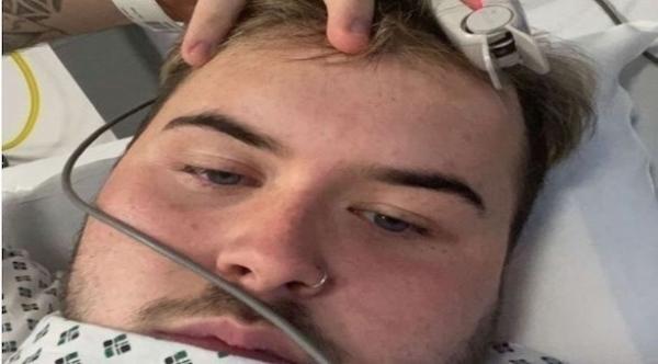 يصاب بسرطان الجلد القاتل بسبب هوسه  بتسمير بشرته