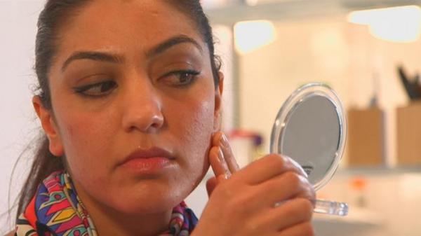 الهاتف الذكي والنظارة..أسباب غير متوقعة لحب الشباب