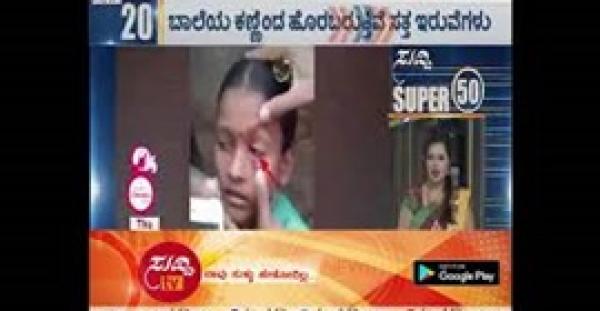 لحظة إزالة 60 نملة من عين فتاة (فيديو )