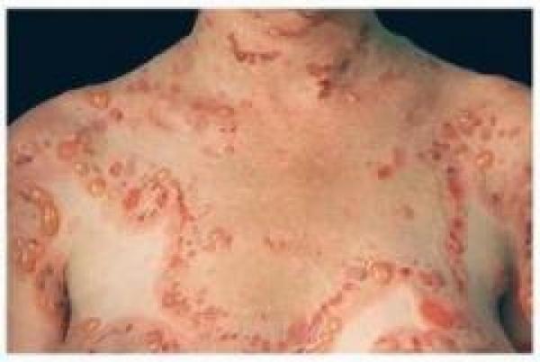 نداء إلى ذوي القلوب الرحيمة: سامية في خطر