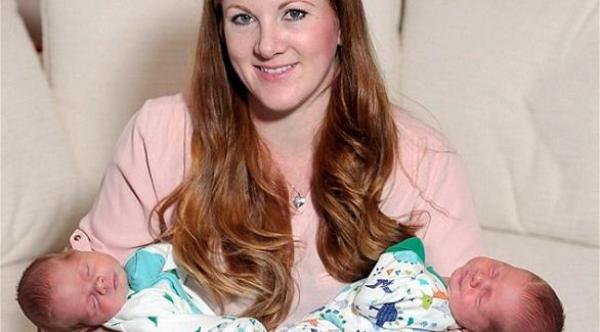 بالصور: ولادة أضخم توأم في اسكتلندا