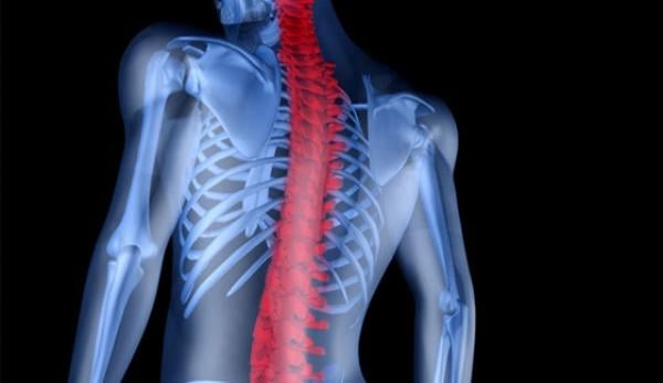 ما يجب أن تعرفه عن التهاب فقرات الظهر