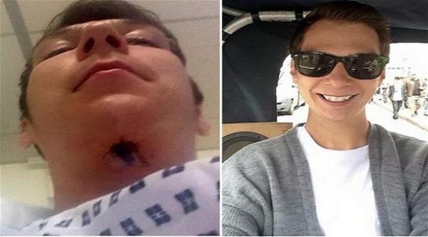 بريطاني يستخدم مبيضاً للأسنان تسبب في ثقب في فمه