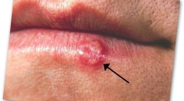 علامات تكشف نقص بعض المغذيات في جسمك