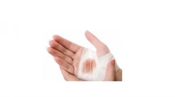 جهاز إلكتروني مرن لمراقبة معدل اندمال الجروح