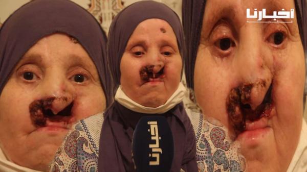 وجدة...سيدة تعاني من السرطان منذ 16 عاما تناشد القلوب الرحيمة للتكفل بدواء قيمته 5 ملايين شهريا