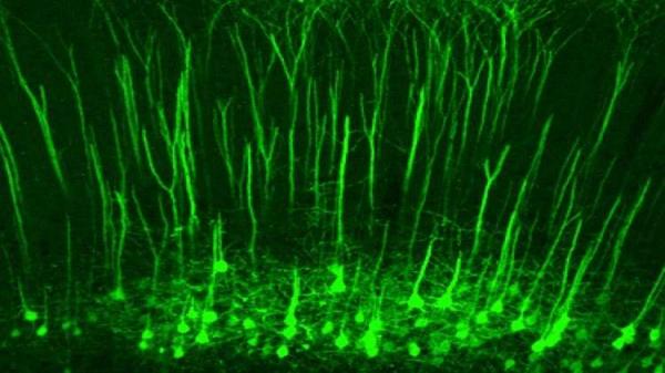 اكتشاف في الدماغ قد يخلص الملايين من آلام الأعصاب المزمنة