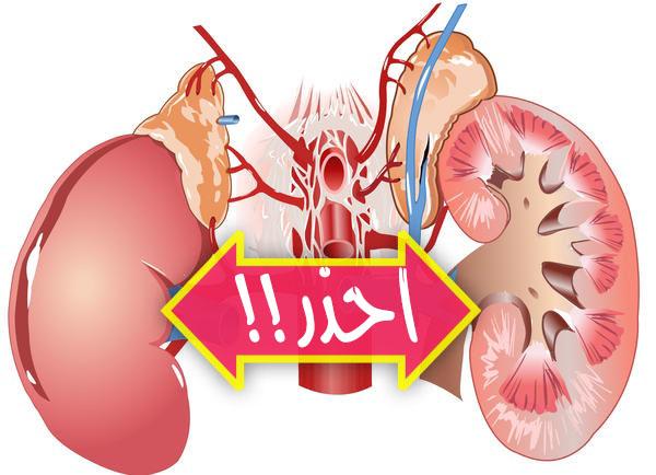 10 عادات تدمر الكلى أحذر منها لتحافظ على صحة الكليتين