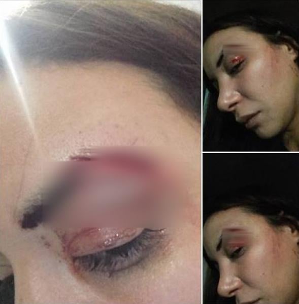 ولاية أمن الدار البيضاء تكشف حقيقة ادعاءات لبنى أبيضار بعد تعرضها لاعتداء