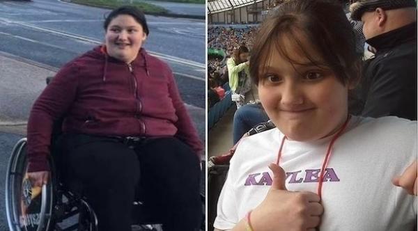 يتهمان بقتل ابنتهما بعد إهمالهما مراقبة نظامها الغذائي