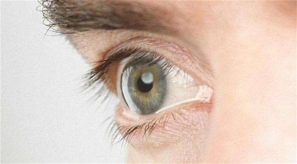 عداء "تتجمّد" عينه في سباق ماراثون بأجواء عاصفة