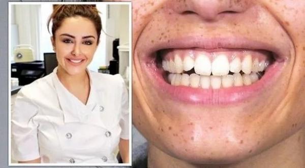 أخصائية  تنصح بشرب المياه بعد الأكل للحفاظ على أسنان بيضاء اللون