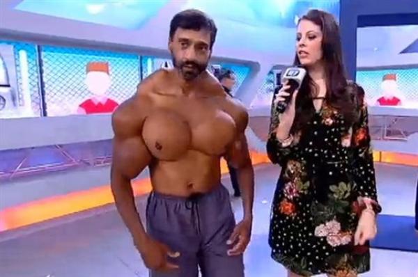 بالفيديو والصور.. رجل يشوه جسمه بحقن «تضخيم العضلات»