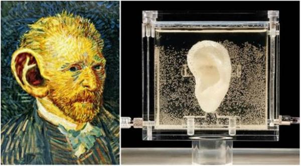 أذن فان جوخ تعود للحياة.. وبإمكانها سماعك