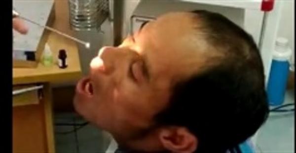 طبيب يستخرج كائنًا غريبًا من أنف مريض (فيديو)