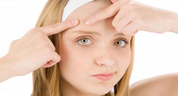 تعانين من حب الشباب ؟ احذري هذه الأطعمة