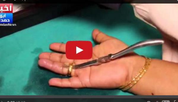 بالفيديو: تستعين برجال الإطفاء لتنتزع خاتماً انحشر بيدها