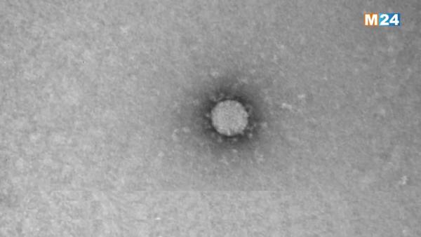 علماء روس ينشرون أول صورة مجهرية لفيروس كورونا