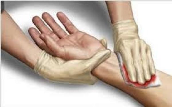 ابتكار ضمادة سائلة لعلاج بثور الفم واللسان