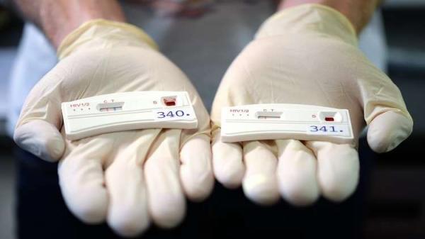 تتوالى المفاجأت: شفاء ثالث شخص في العالم من "السيدا"